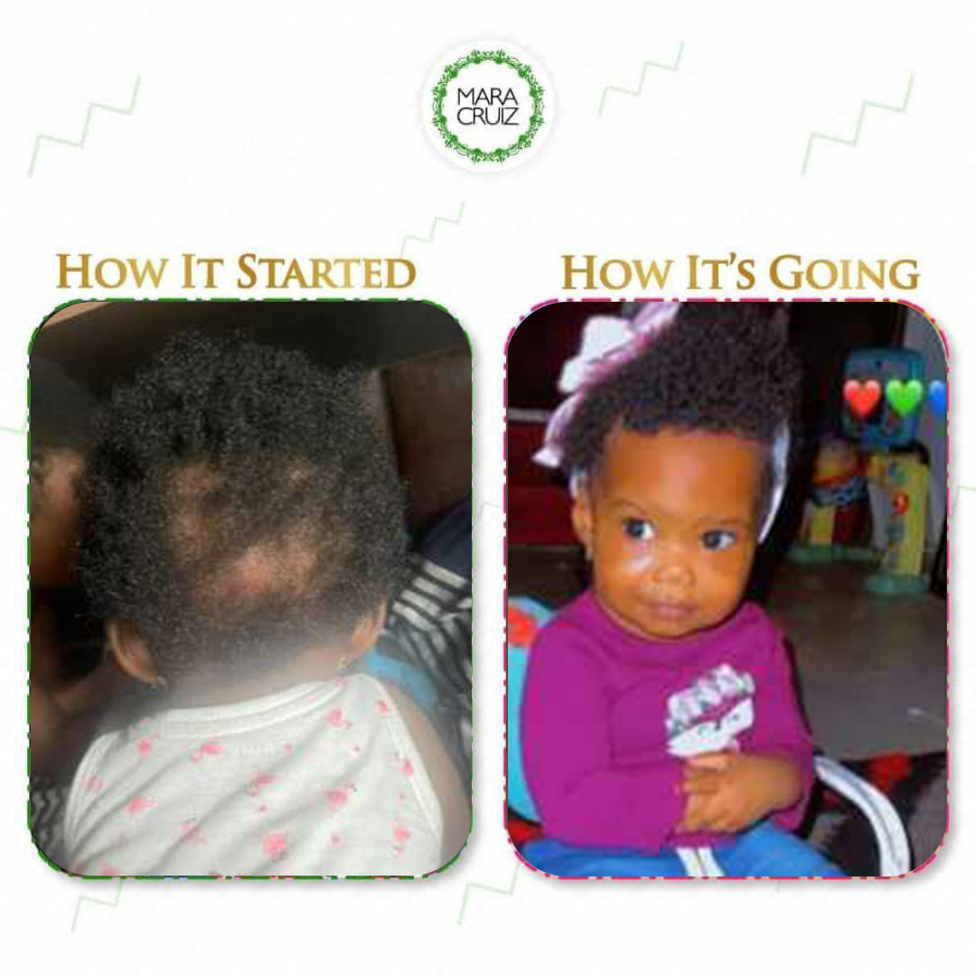 before and after